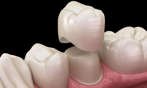Praveen Dental Hospital - Hanamkonda