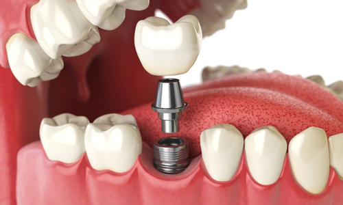 Praveen Dental Hospital - Hanamkonda