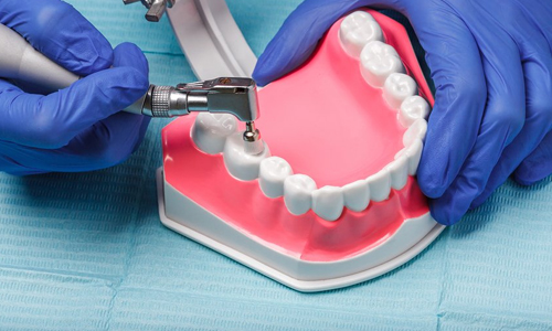 Praveen Dental Hospital - Hanamkonda