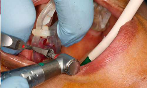 Praveen Dental Hospital - Hanamkonda