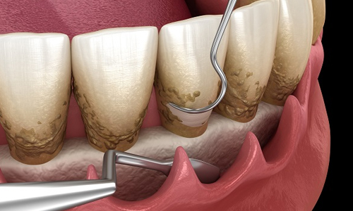 Praveen Dental Hospital - Hanamkonda