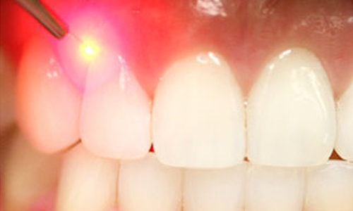 Praveen Dental Hospital - Hanamkonda