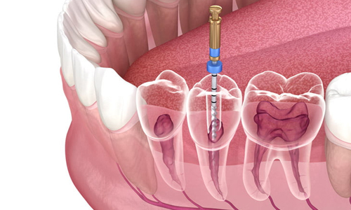 Praveen Dental Hospital - Hanamkonda
