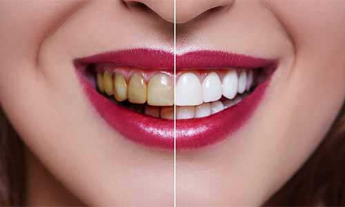 Praveen Dental Hospital - Hanamkonda